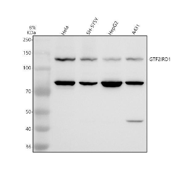 Western blot analysis of GTF2IRD1 using anti-GTF2IRD1 antibody (A04254-3)