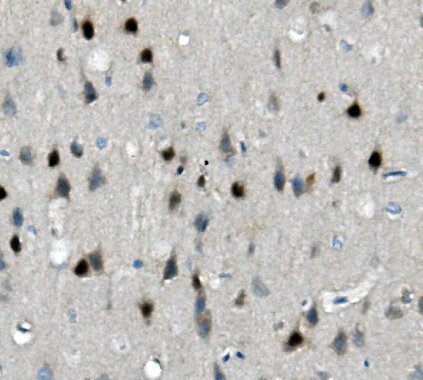 a04255 calb2 primary antibodies ihc testing 2