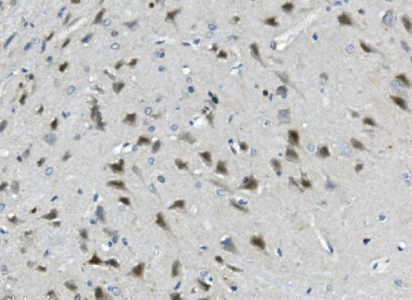 a04255 calb2 primary antibodies ihc testing 3