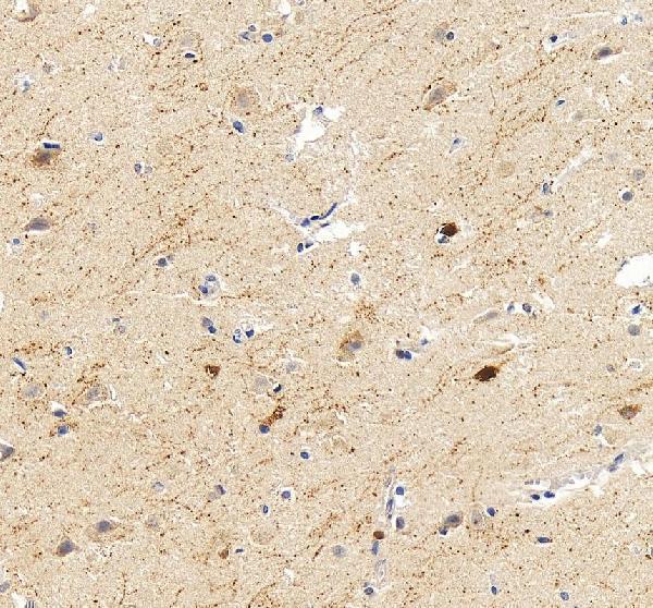 a04255 calb2 primary antibodies ihc testing 4