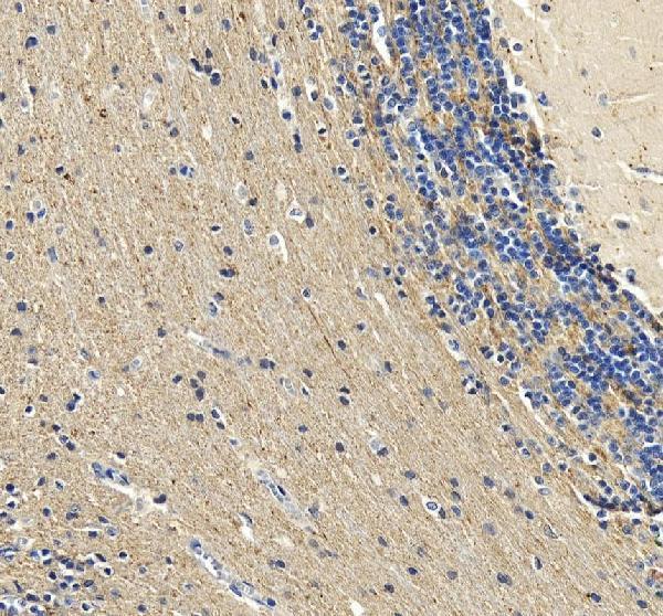 a04255 calb2 primary antibodies ihc testing 5