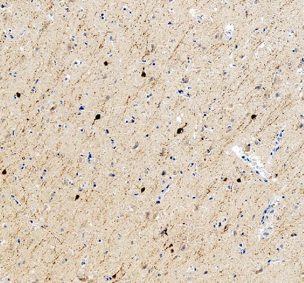 a04255 calb2 primary antibodies ihc testing 6