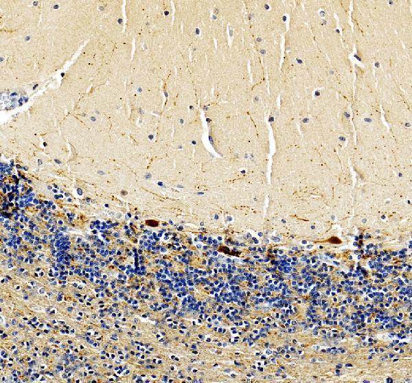 a04255 calb2 primary antibodies ihc testing 7