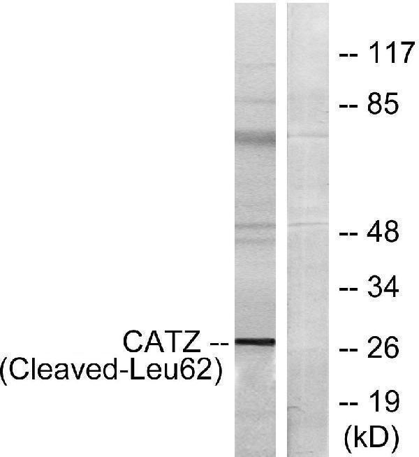 Western blot analysis of lysates from COS7 cells, treated with etoposide 25uM 1h, using CATZ (Cleaved-Leu62) Antibody