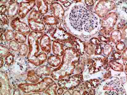 Immunohistochemical analysis of paraffin-embedded human-kidney, antibody was diluted at 1:200