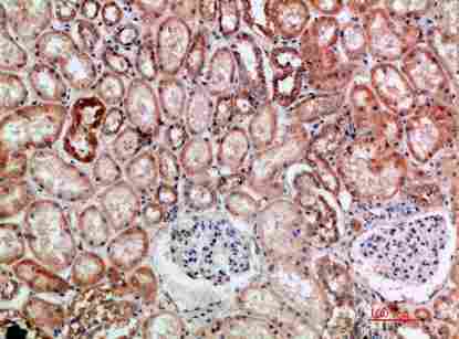 Immunohistochemical analysis of paraffin-embedded human-kidney, antibody was diluted at 1:200