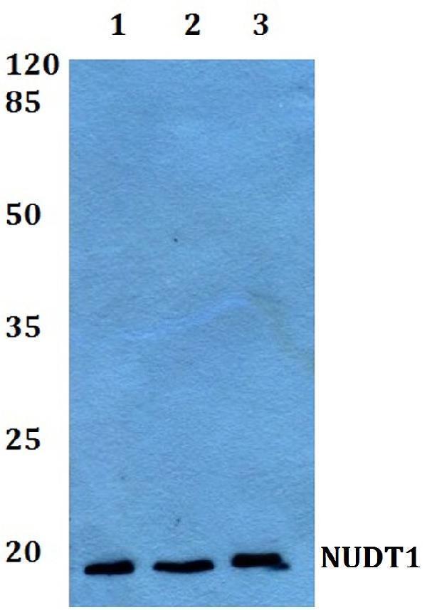 Western blot (WB) analysis of NUDT1 polyclonal antibody at 1:500 dilution
Lane1:A549 whole cell lysate
Lane2:Mouse liver tissue lysate
Lane3:Rat brain tissue lysate