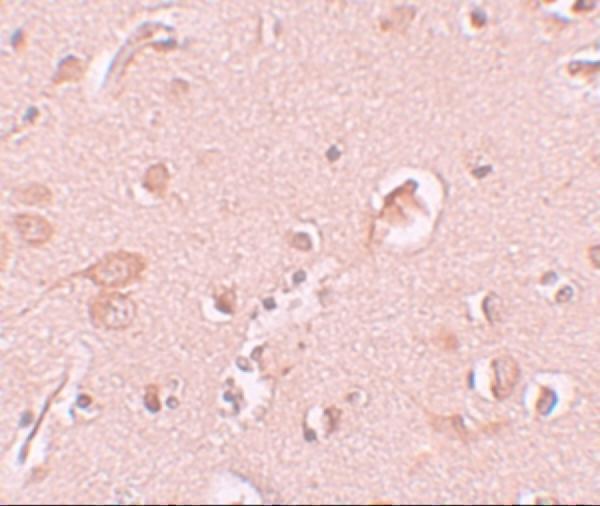 a04259 stau1 primary antibodies ihc testing 2