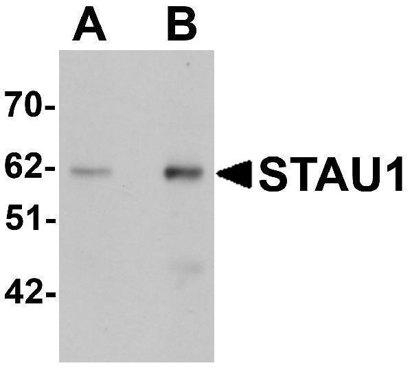 a04259 stau1 primary antibodies wb testing 1