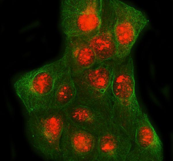  IF analysis of SPIDR using anti-SPIDR antibody (A04260-1) and anti-Beta Tubulin antibody (M01857-3)