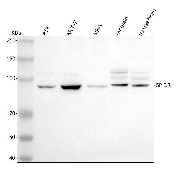  Western blot analysis of SPIDR using anti-SPIDR antibody (A04260-1)