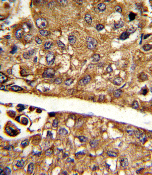 a04262 1 anti mdh1 antibody c term ihc p testing 2
