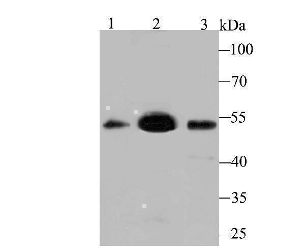 Western blot analysis of MEIS2 on different lysates using anti-MEIS2 antibody at 1/500 dilution