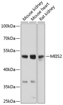 a04264 meis2 primary antiboties wb testing 1