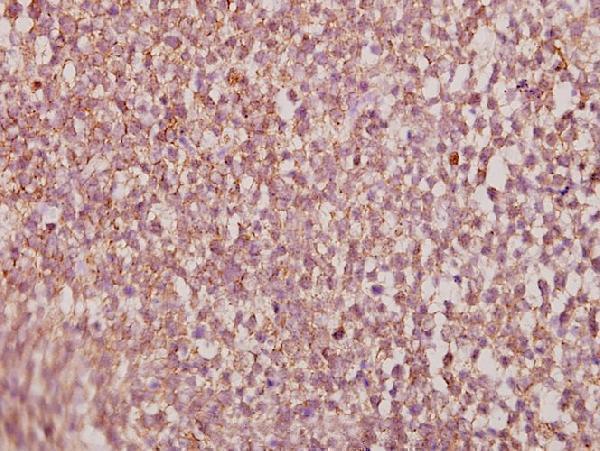 a04268y248 hoxa11 primary antiboties ihc testing 2