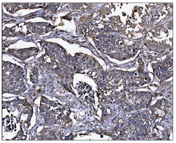a04269 1 erap2 primary antibodies ihc testing 2