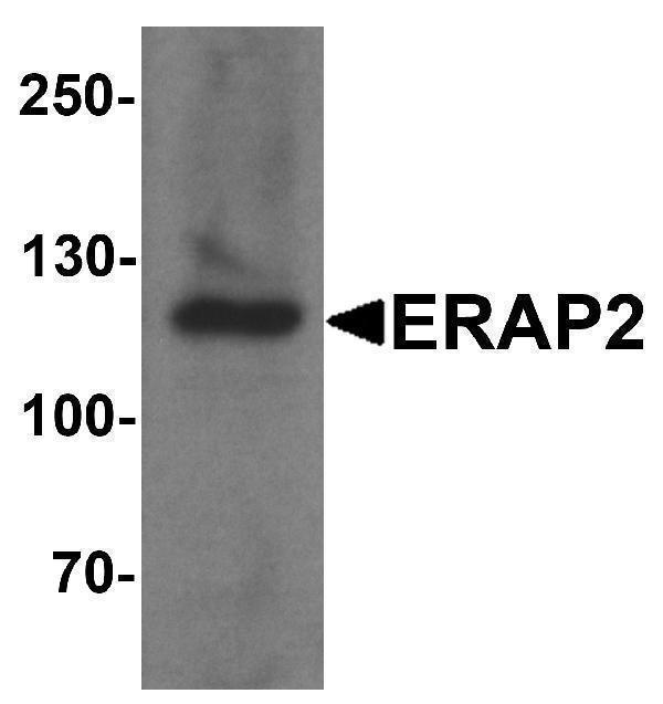 a04269 erap2 primary antibodies wb testing 1
