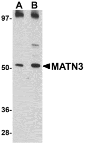 Western blot analysis of MATN3 in 3T3 cell lysate with MATN3 antibody at (A) 1 and (B) 2 μg/mL