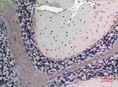 a04273 fgf20 primary antibodyes ihc testing 1