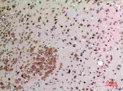 a04273 fgf20 primary antibodyes ihc testing 3