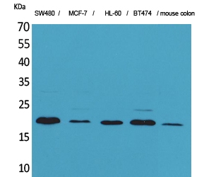 a04273 fgf20 primary antibodyes wb testing 2