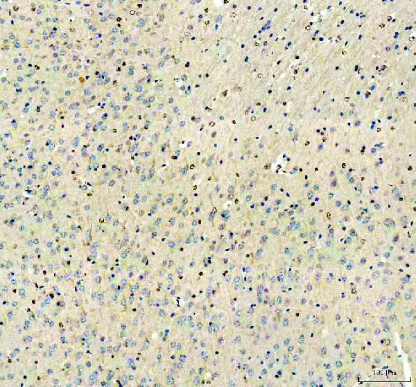  IHC analysis of ZBTB20 using anti-ZBTB20 antibody (A04274-1)