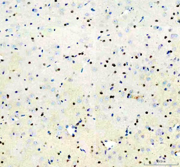  IHC analysis of ZBTB20 using anti-ZBTB20 antibody (A04274-1)
