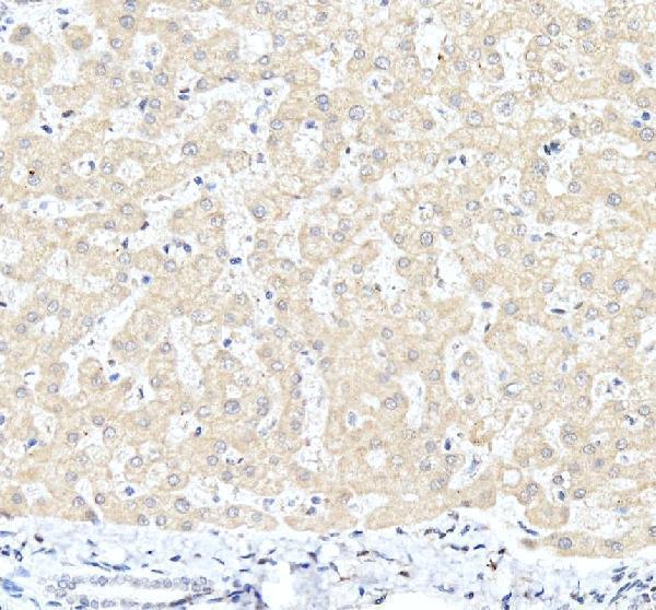 a04274 1 zbtb20 primary antibodies ihc testing 4