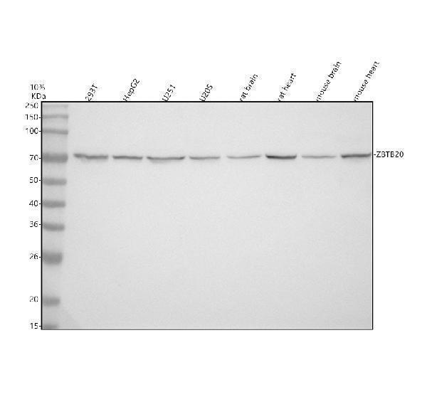  Western blot analysis of ZBTB20 using anti-ZBTB20 antibody (A04274-1)