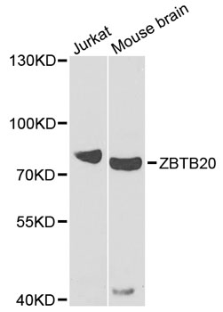 a04274 zbtb20 primary antiboties wb testing 1
