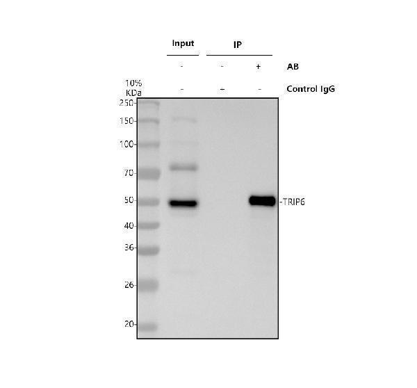 Immunoprecipitating TRIP6 in Hela whole cell lysate