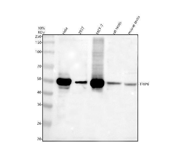 Western blot analysis of TRIP6 using anti-TRIP6 antibody (A04275-2)