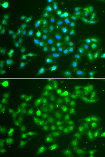 Immunofluorescence analysis of NIH/3T3 cells using UCHL5 Rabbit pAb  at dilution of 1:50 