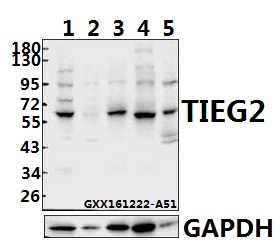 Western blot (WB) analysis of TIEG2 (F6) polyclonal antibody at 1:500 dilution
Lane1:HEK293T whole cell lysate(40ug)
Lane2:THP-1 whole cell lysate(40ug)
Lane3:SGC7901 whole cell lysate(40ug)
Lane4:H9C2 whole cell lysate(40ug)
Lane5:The Heart tissue lysate of Mouse(40ug)