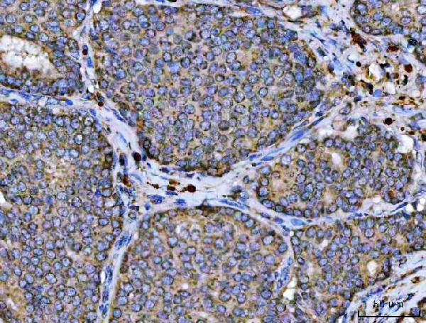  IHC analysis of ARL13B using anti-ARL13B antibody (A04279-1)