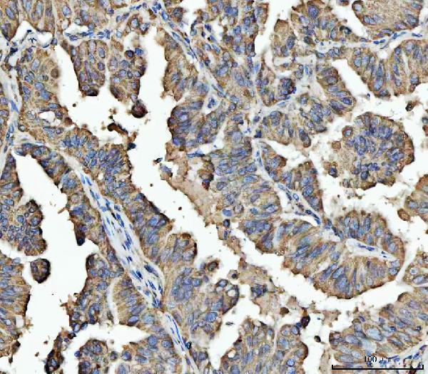  IHC analysis of ARL13B using anti-ARL13B antibody (A04279-1)