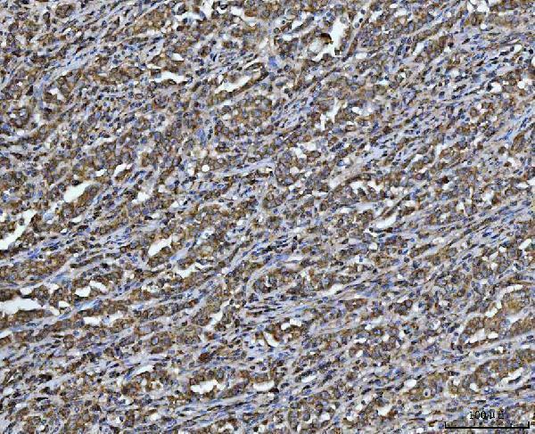 a04279 1 arl13b primary antibodies ihc testing 4
