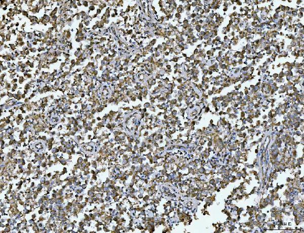 a04279 1 arl13b primary antibodies ihc testing 5