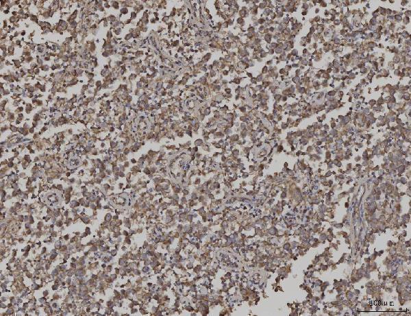 a04279 1 arl13b primary antibodies ihc testing 6