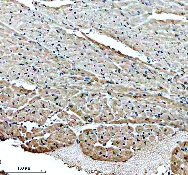 IHC analysis of SMYD2 using anti-SMYD2 antibody (A04281-2)