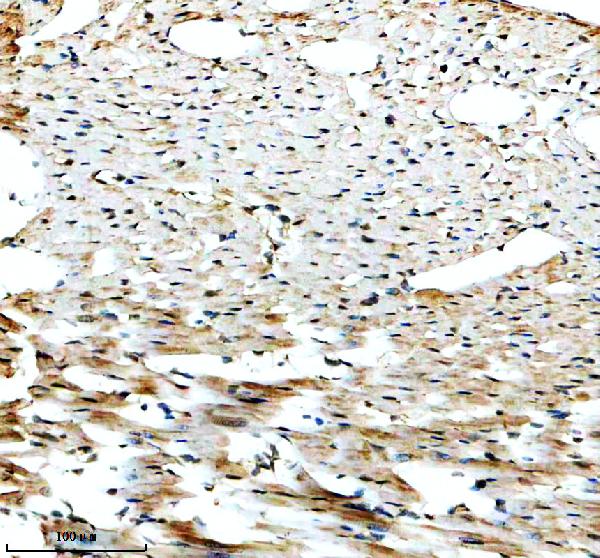 IHC analysis of SMYD2 using anti-SMYD2 antibody (A04281-2)