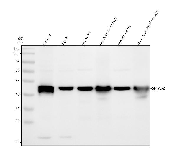 Western blot analysis of SMYD2 using anti-SMYD2 antibody (A04281-2)