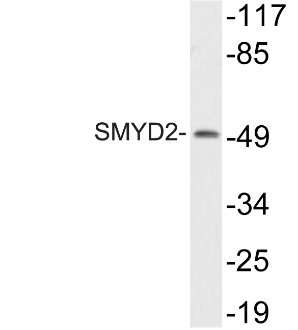 Western blot analysis of lysate from HT29 cells, using SMYD2 antibody