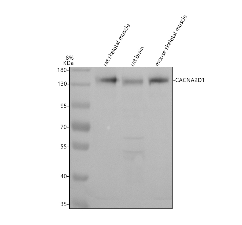 Western blot analysis of CACNA2D1 using anti-CACNA2D1 antibody (A04282-3)