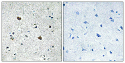 a04286 2 hspa1l primary antibodies ihc testing 1