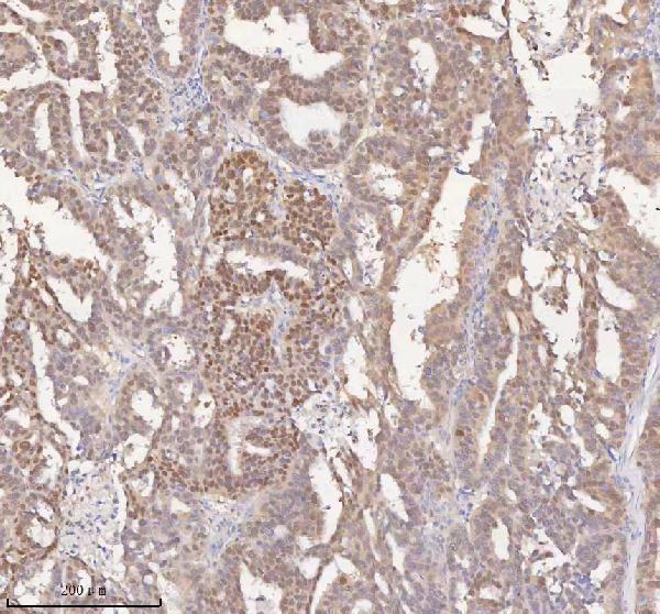  IHC analysis of HSPA1L using anti-HSPA1L antibody (A04286-3)