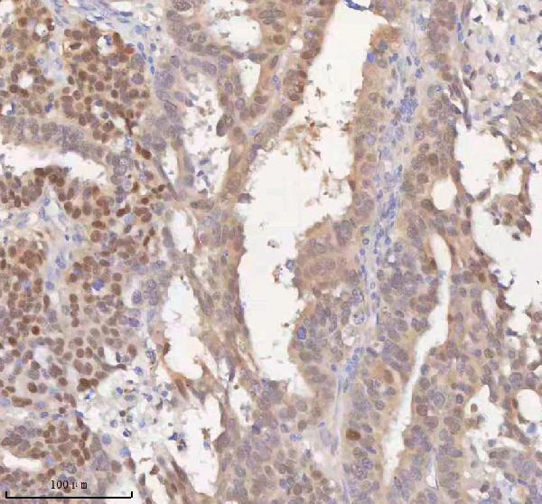  IHC analysis of HSPA1L using anti-HSPA1L antibody (A04286-3)
