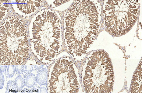 a04286 hspa1l primary antibodies ihc testing 5