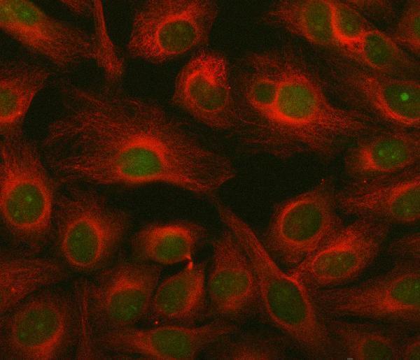  IF analysis of ING2 using anti-ING2 antibody (A04290-3) and anti-Beta Tubulin antibody (M01857-3)
