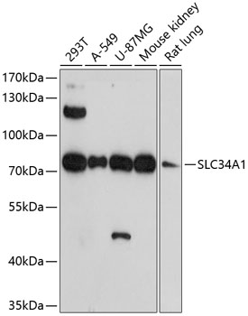 Western blot analysis of extracts of various cell lines, using SLC34A1 antibody at 1:1000 dilution